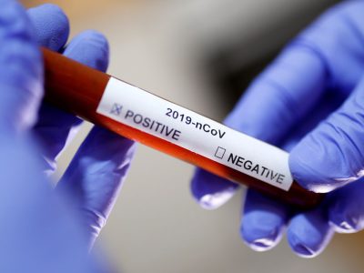 Covid-19: país acumula 20,9 milhões de casos e 586 mil óbitos Covid-19: país acumula 20,9 milhões de casos e 586 mil óbitos