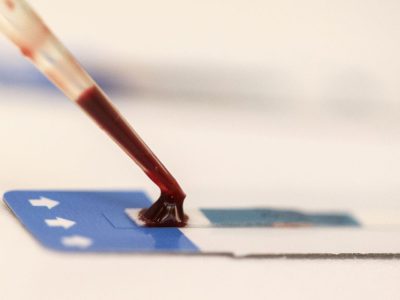 Fiocruz: síndrome respiratória aguda grave mostra tendência de queda Fiocruz: síndrome respiratória aguda grave mostra tendência de queda