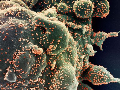 GSK: teste mostra que coquetel de anticorpos funciona contra Ômicron