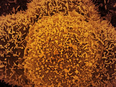 País segue tendência estável de transmissão da covid-19