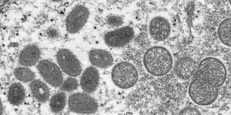 Brasil registra terceiro caso de varíola dos macacos