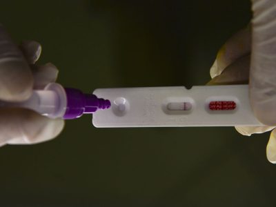 Pesquisadores identificam método capaz de prever gravidade da covid-19