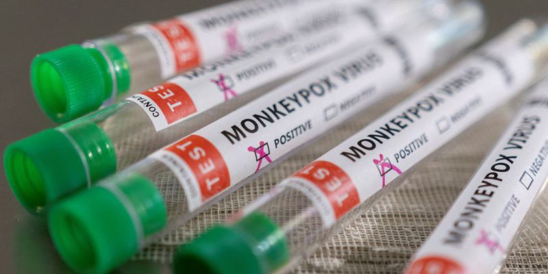 Rio de Janeiro confirma quinto caso de varíola dos macacos
