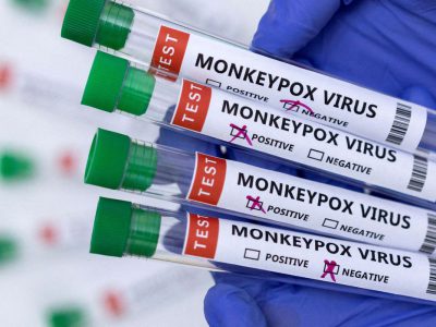 Casos de varíola dos macacos chegam a 76 em todo o país