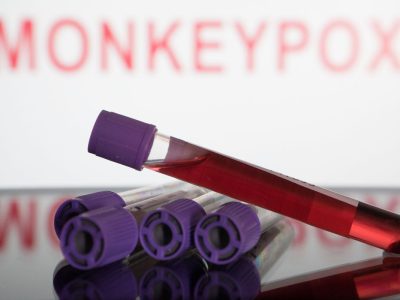 Sociedades médicas alertam sobre cuidados com a varíola dos macacos