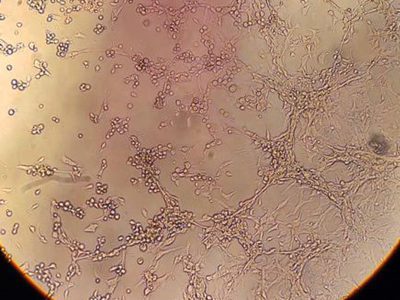 SP: Praia Grande confirma morte de homem por varíola dos macacos