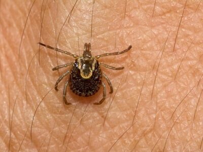 O que é febre maculosa e quais os sintomas