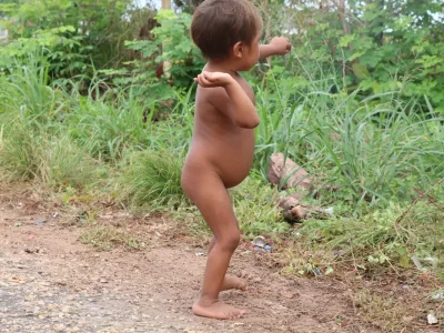 Garimpo ilegal ainda ameaça saúde em território yanomami