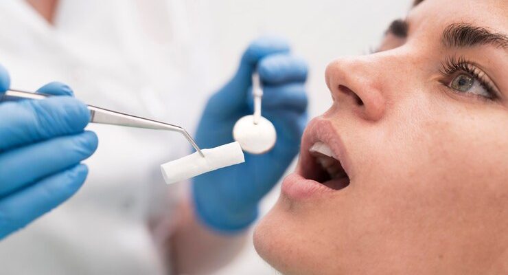 Dentes do Siso: Extração e Cuidados Necessários Dentes do Siso: Extração e Cuidados Necessários