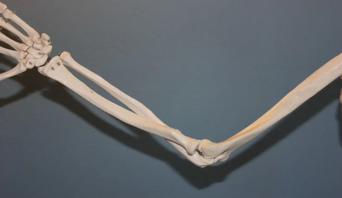 Startup brasileira cria método inovador para converter gesso em osso humano