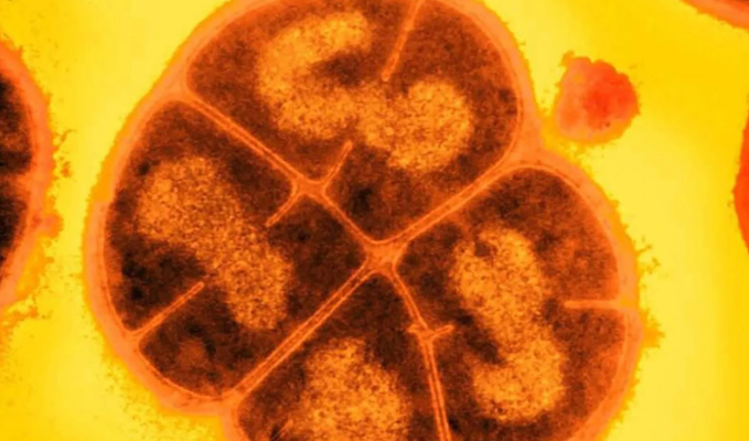 Cientistas anunciam descoberta de recurso singular contra a radiação