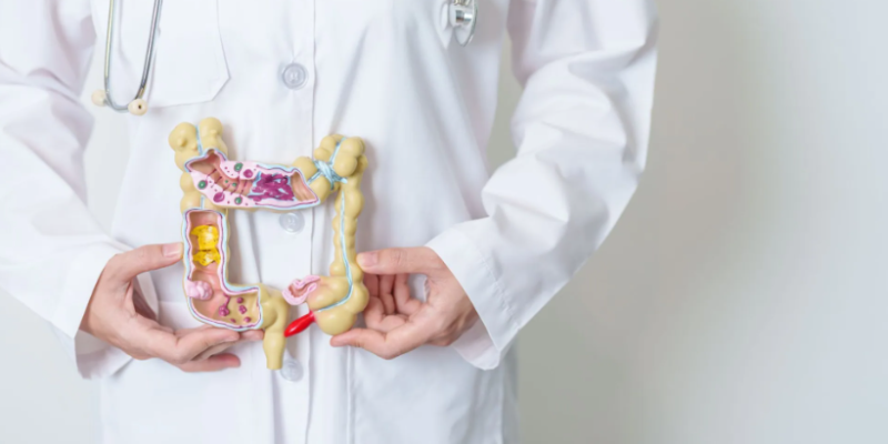 Crescimento do Câncer de Intestino entre Jovens Alerta Comunidade Científica Global