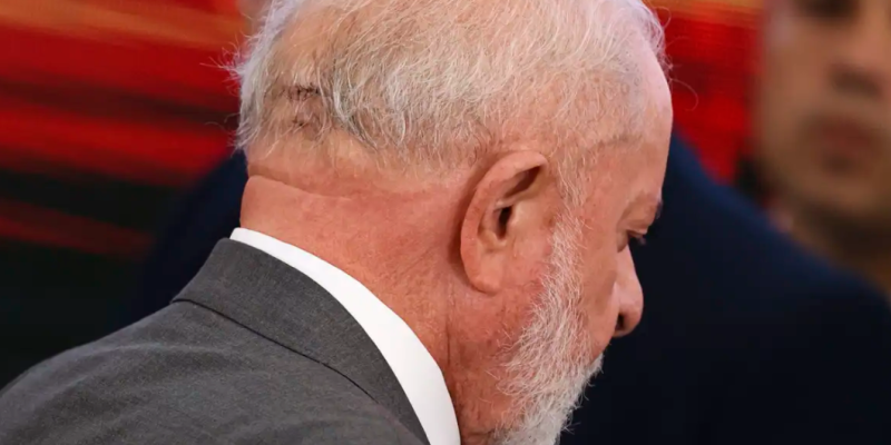 Caso de Lula: Neurologista Discute a Prevalência do Hematoma Subdural Crônico