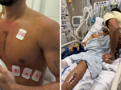 Influenciador baleado em assalto relembra o crime: “Bala foi parar dentro do coração”